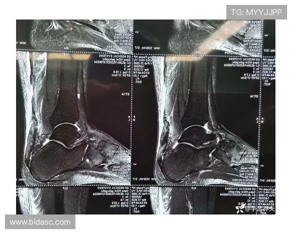 澳洲米勒跟腱断裂无缘世界杯